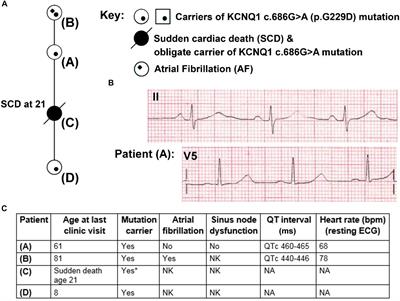 Investigating the Complex Arrhythmic Phenotype Caused by the Gain-of-Function Mutation KCNQ1-G229D